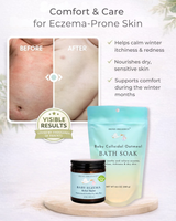 Baby Eczema Relief Bundle