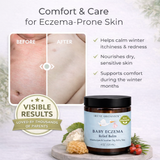 Eczema Relief Balm