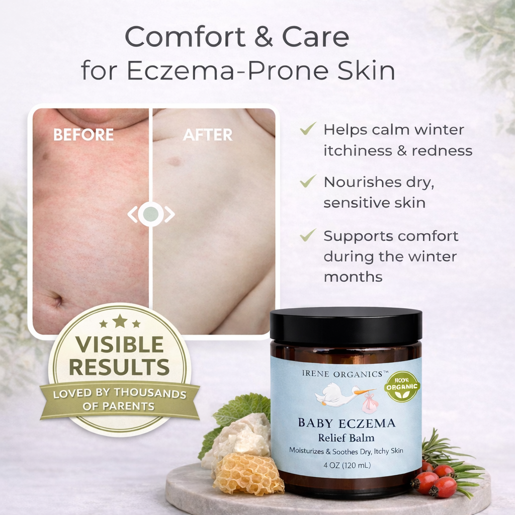 Eczema Relief Balm