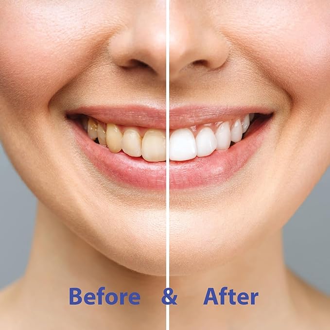 Super Whitening Cinnamon Toothpaste Tablets