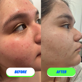 Skin Saver for Tweens