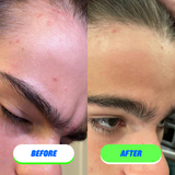 Skin Saver for Tweens