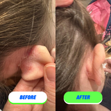 Skin Saver for Tweens